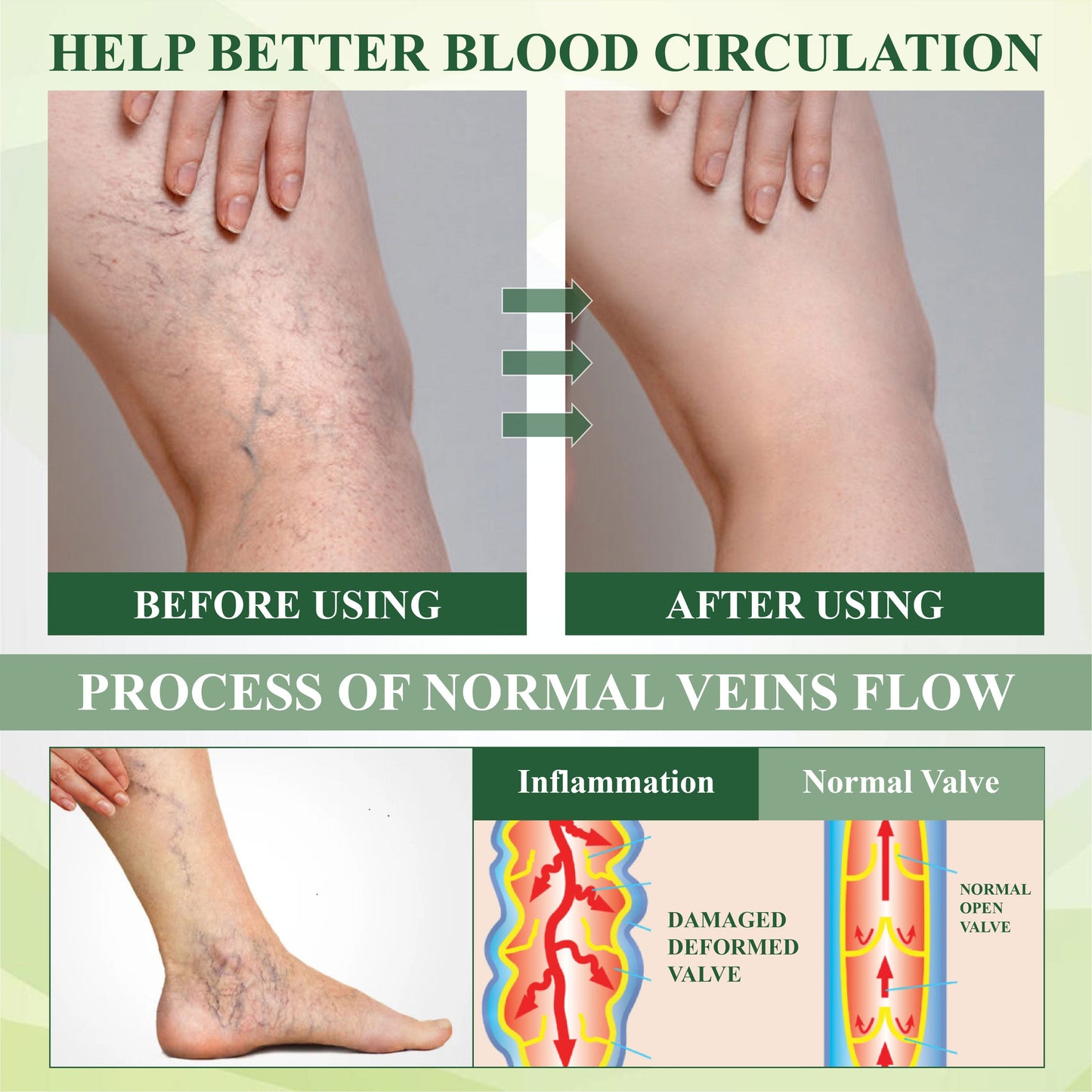 HomeCleanGoods™ FluidEase Leg Therapy Edema Cream