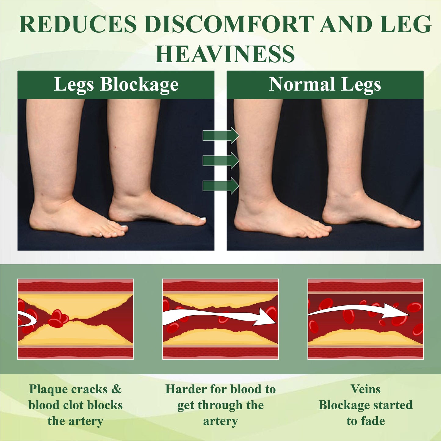HomeCleanGoods™ FluidEase Leg Therapy Edema Cream