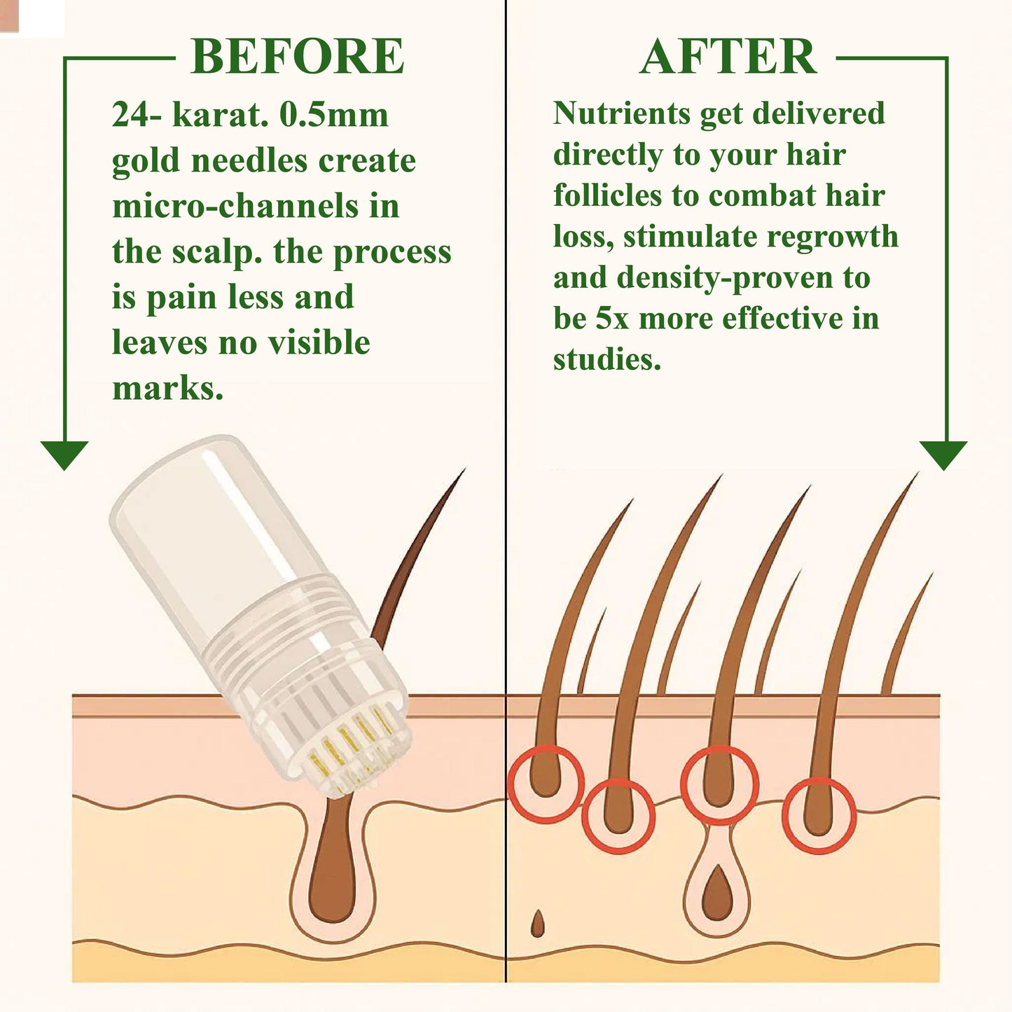 HomeCleanGoods™ ManGro EGCG Microneedle Scalp Essence Kit