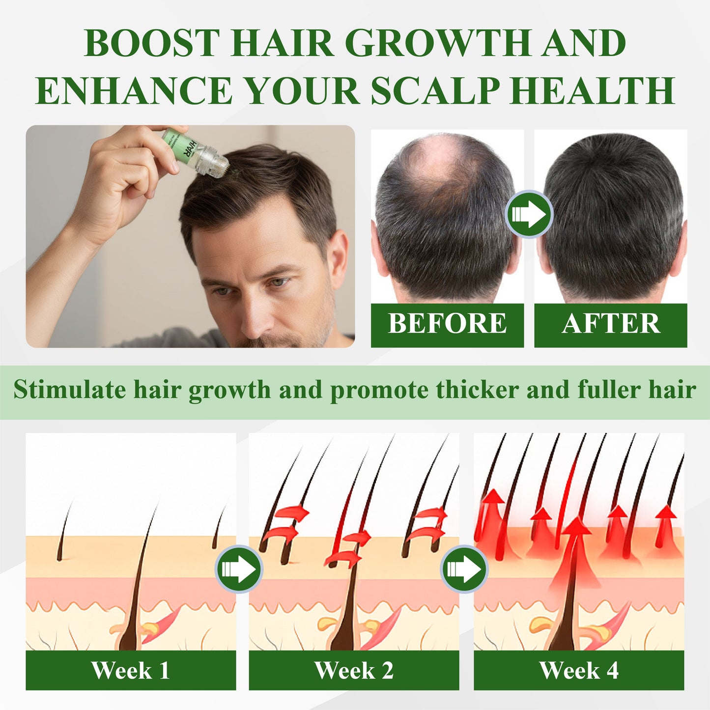 HomeCleanGoods™ ManGro EGCG Microneedle Scalp Essence Kit