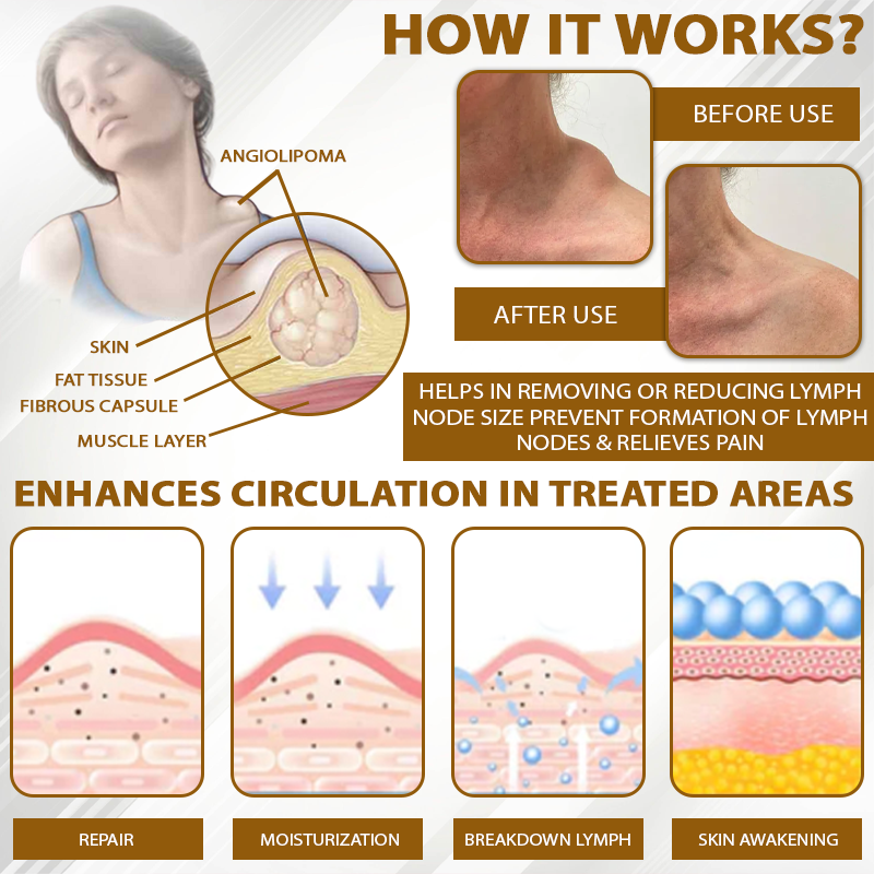 HomeCleanGoods™ SwellingCare ApisVenom Cream Roller