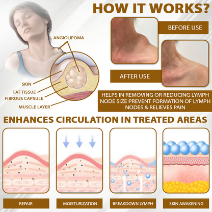 HomeCleanGoods™ SwellingCare ApisVenom Cream Roller