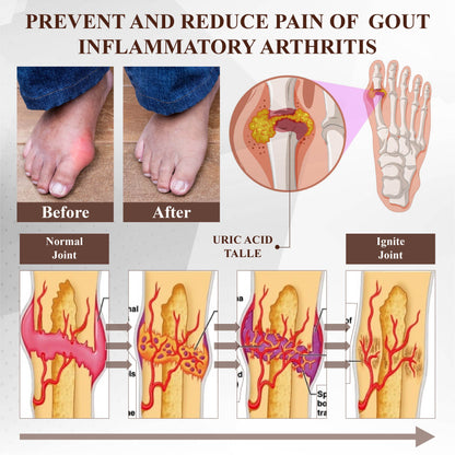 HomeCleanGoods™ Emu Oil Turmeric Bone Sooth Gel