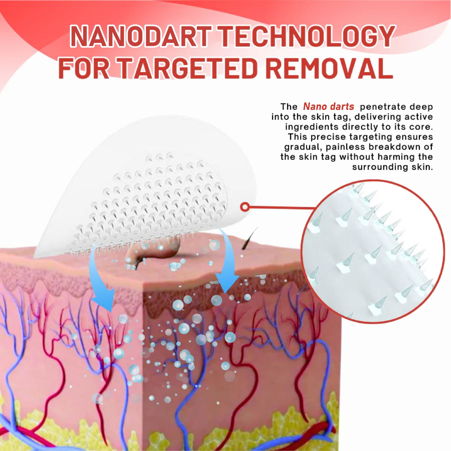 HomeCleanGoods™ NanoDart Skin Tag Removal Patches