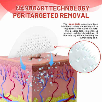 HomeCleanGoods™ NanoDart Skin Tag Removal Patches
