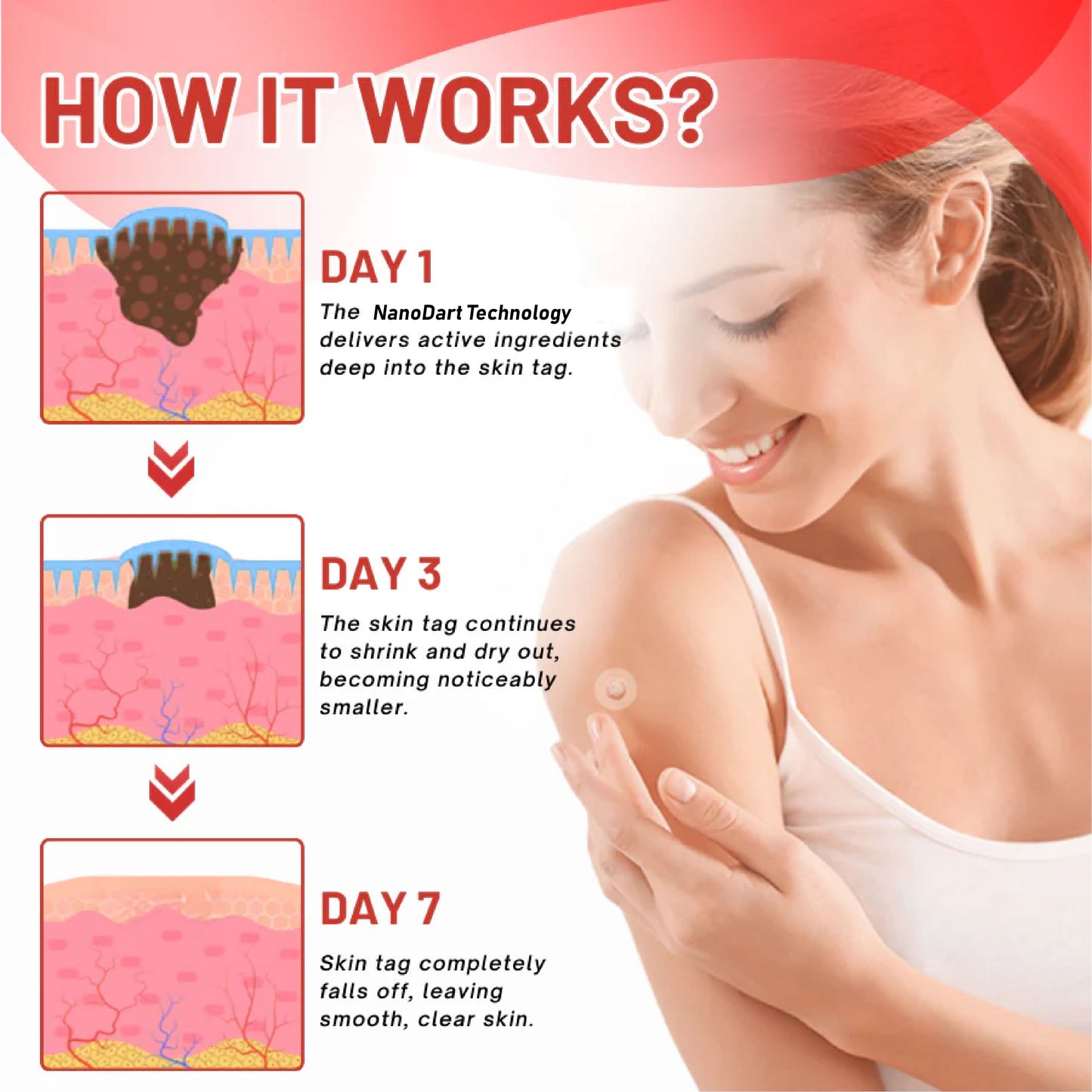 HomeCleanGoods™ NanoDart Skin Tag Removal Patches