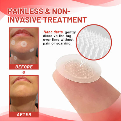 HomeCleanGoods™ NanoDart Skin Tag Removal Patches