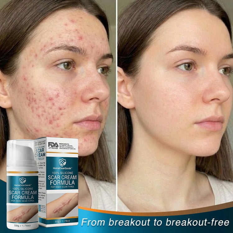 HomeCleanGoods™ 100% Silicone Scar Cream Formula