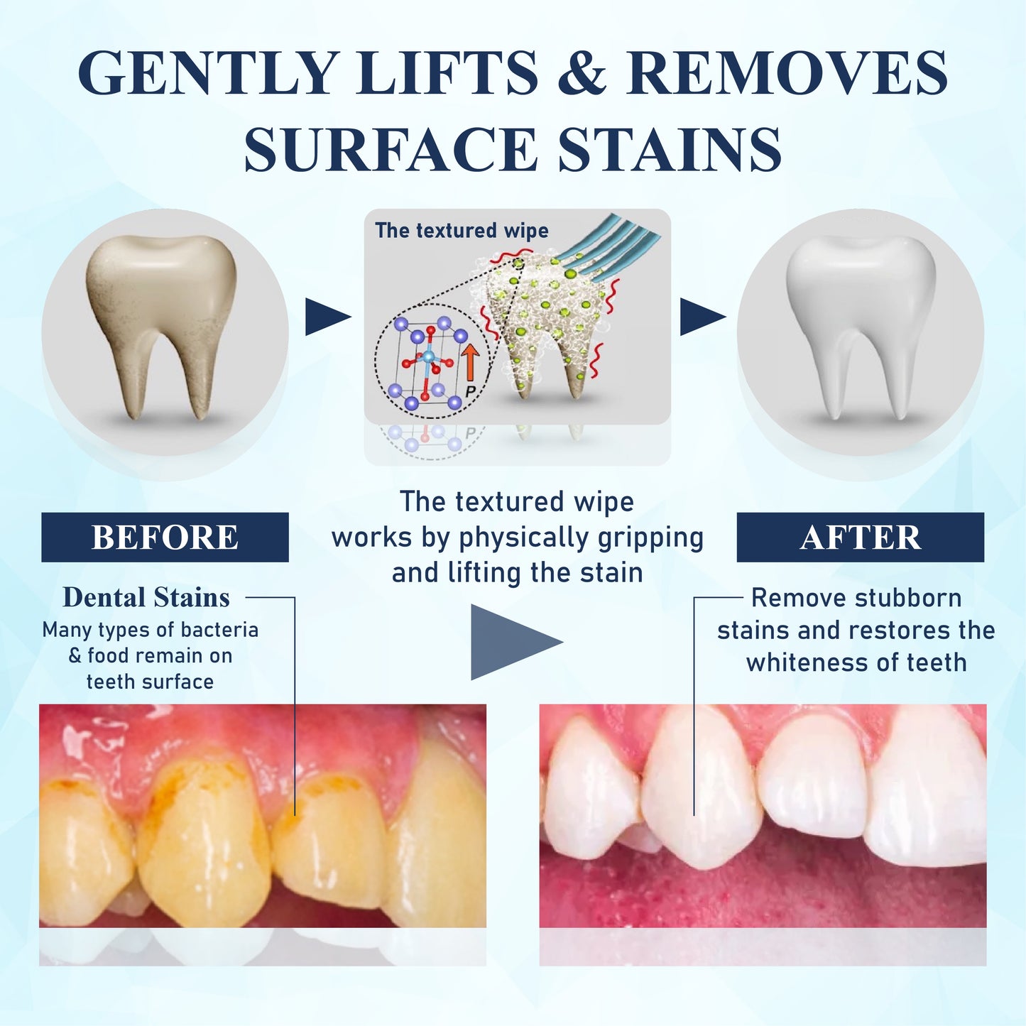 HomeCleanGoods™ BrighteWipe Teeth Cleaning Finger Wipes