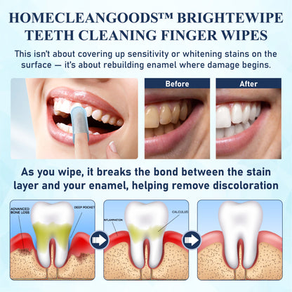 HomeCleanGoods™ BrighteWipe Teeth Cleaning Finger Wipes