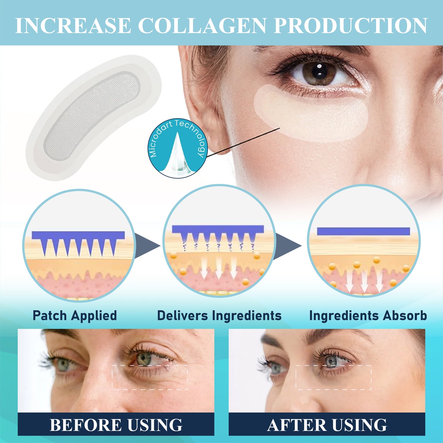 HomeCleanGoods™ EyeRenew Microneedle Intensive Patch