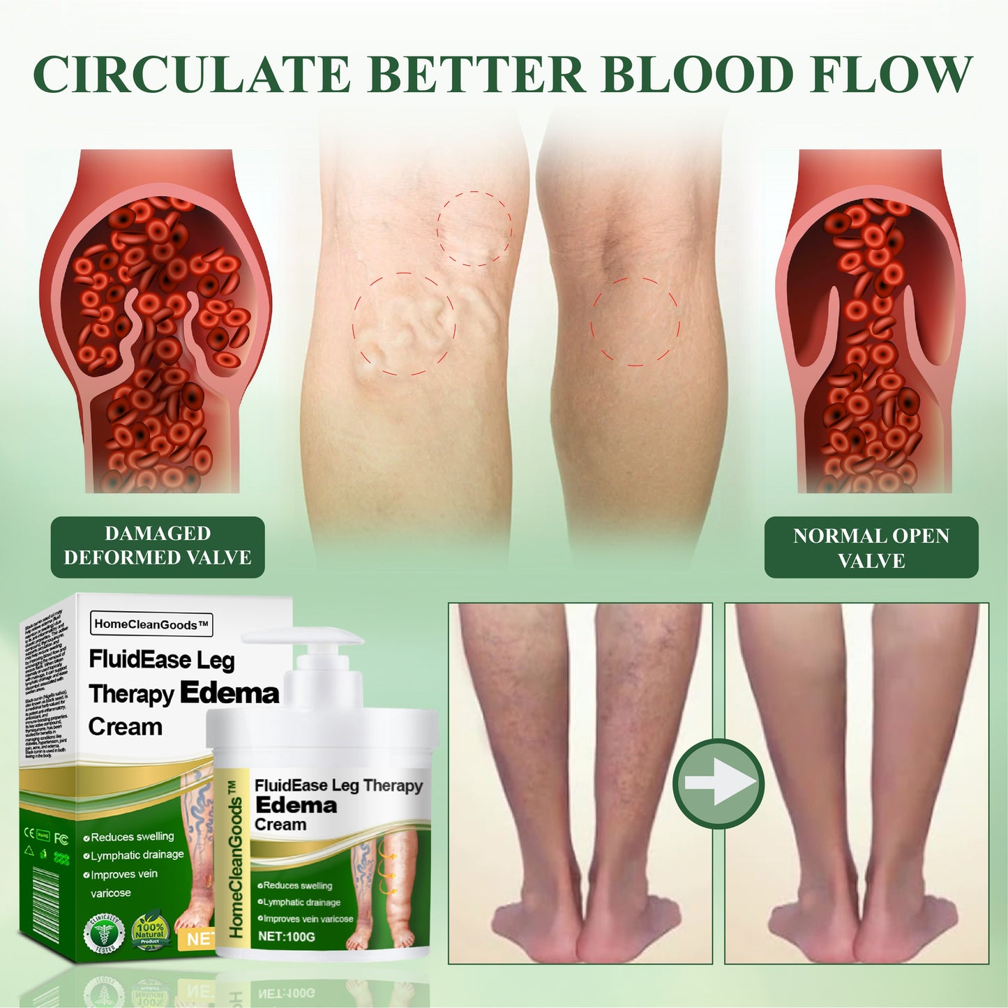 HomeCleanGoods™ FluidEase Leg Therapy Edema Cream