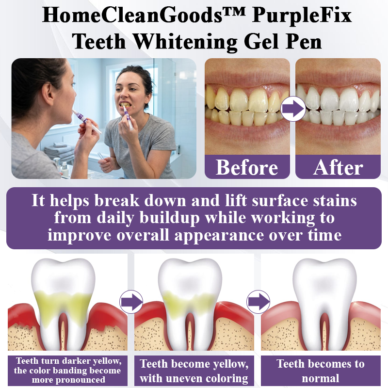 HomeCleanGoods™ PurpleFix Teeth Whitening Gel Pen