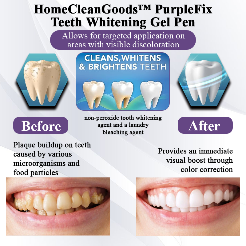 HomeCleanGoods™ PurpleFix Teeth Whitening Gel Pen