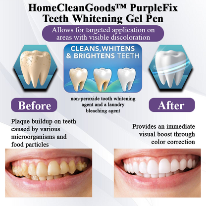 HomeCleanGoods™ PurpleFix Teeth Whitening Gel Pen