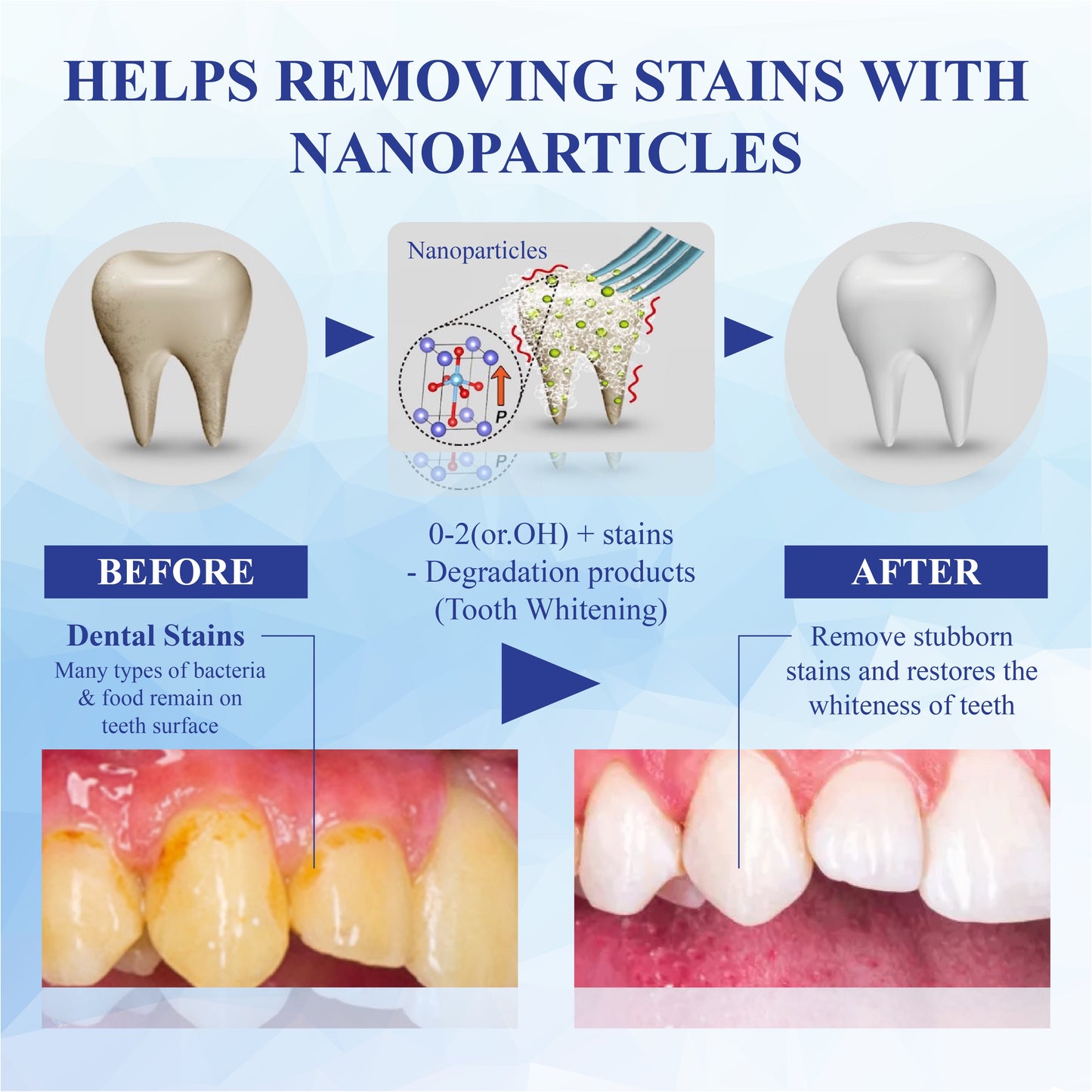 HomeCleanGoods™ SmilePolish Nano Teeth Stain Cleaner