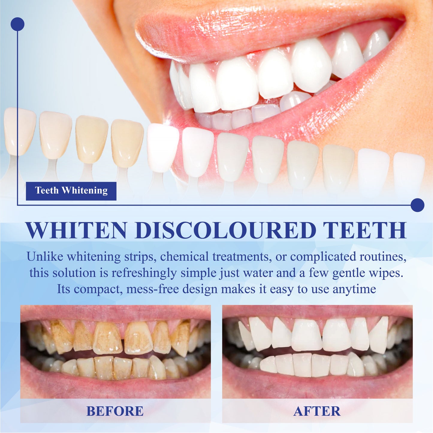 HomeCleanGoods™ SmilePolish Nano Teeth Stain Cleaner