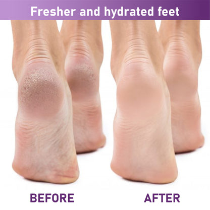 HomeCleanGoods™ SmoothStep Exfoliating Foot Peel Mask Sock