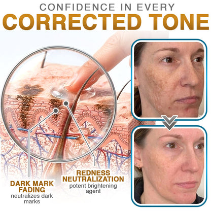 HomeCleanGoods™ 100% Silicone Scar Cream Formula