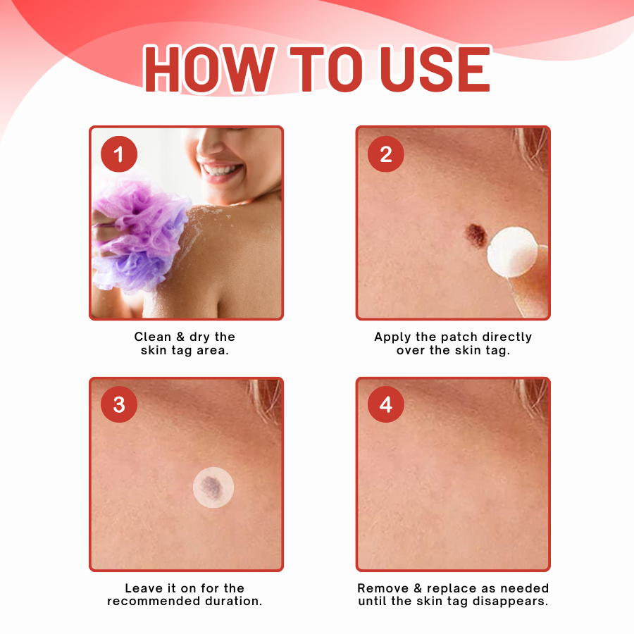 HomeCleanGoods™ NanoDart Skin Tag Removal Patches